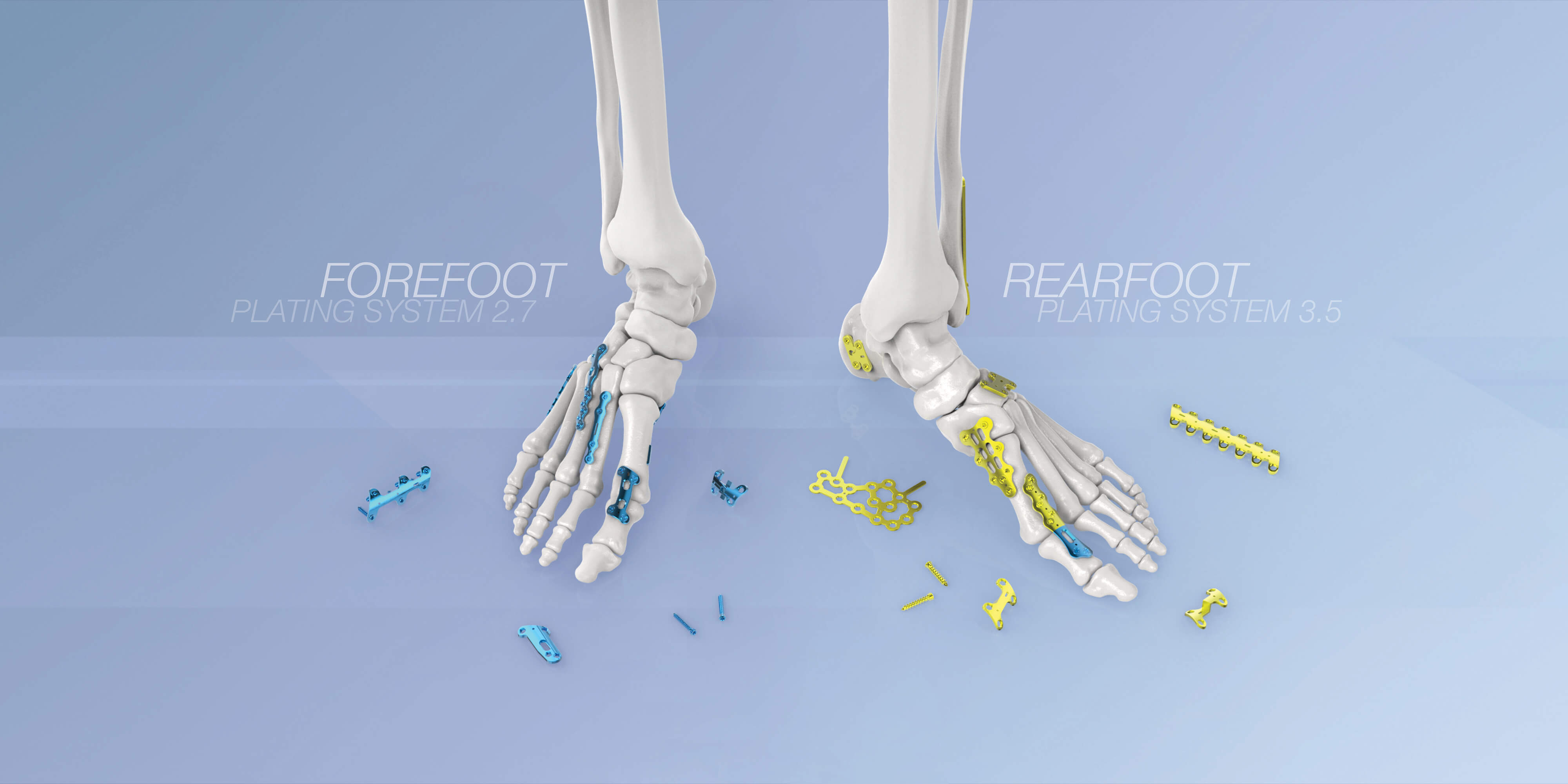AGOME Fore-Rear System